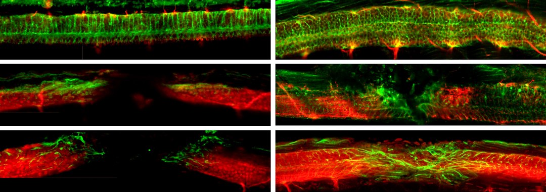 Esperança. Nanotecnologia repara espinhal dorsal e cura paralisia em animais ( Nature Materials)